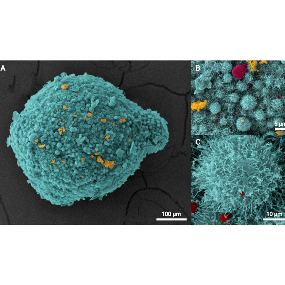 Osteomicroesfera humana