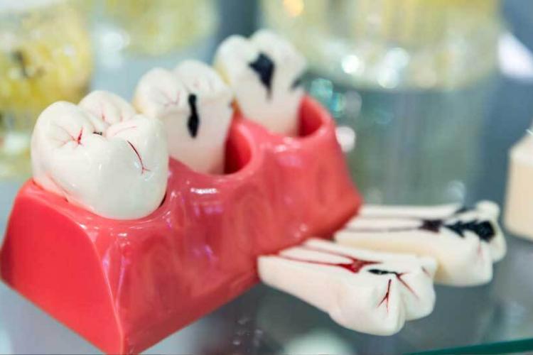 Se mantienen a la vanguardia estudiantes de la Licenciatura en Médico Cirujano Dentista de la Universidad Anáhuac Cancún
