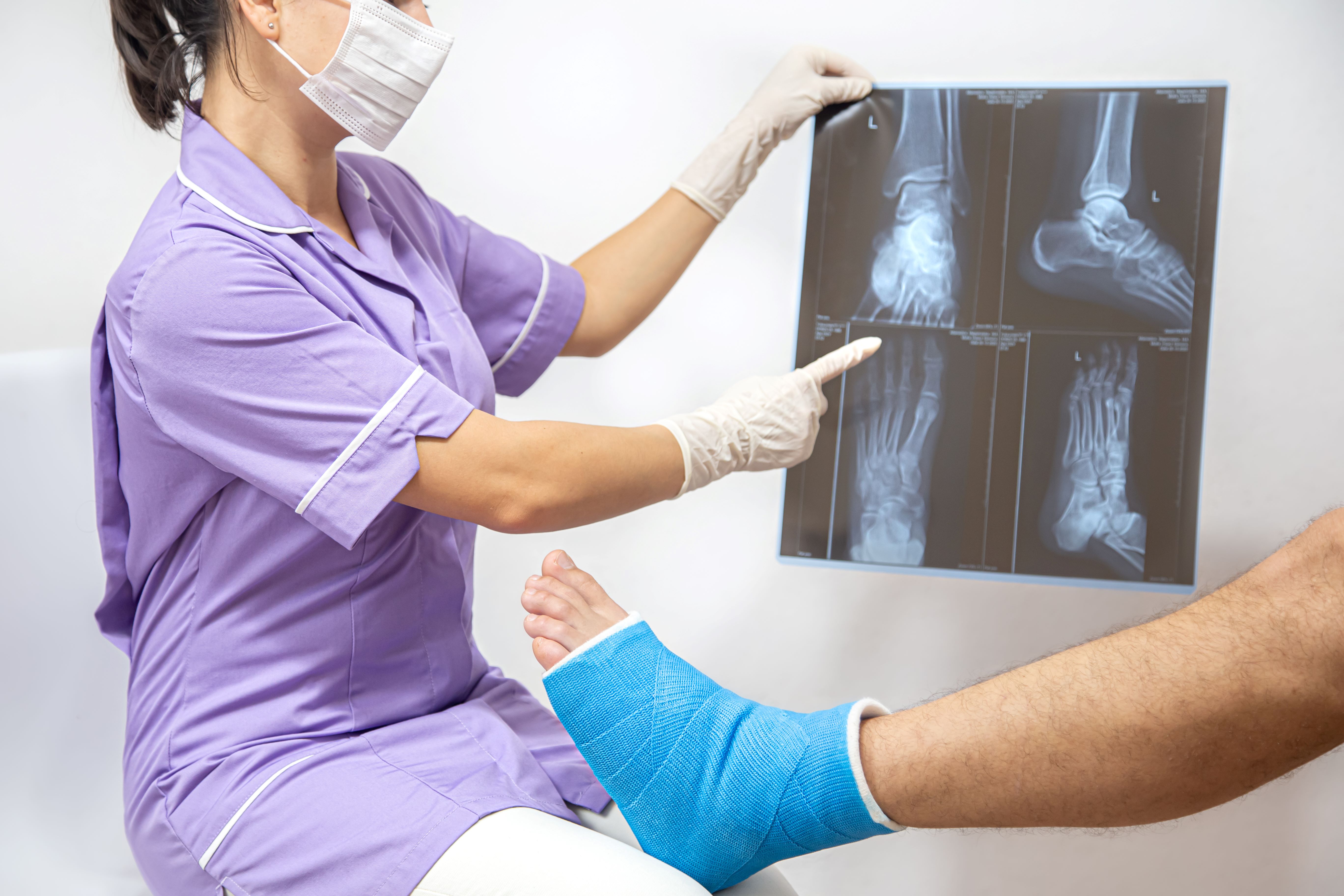 Imagen de un pie con fractura y una doctora viendo una radiografía.