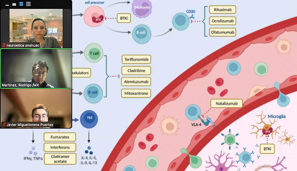 Enfoques terapéuticos y reflexiones bioéticas sobre esclerosis múltiple en Food for the Brain