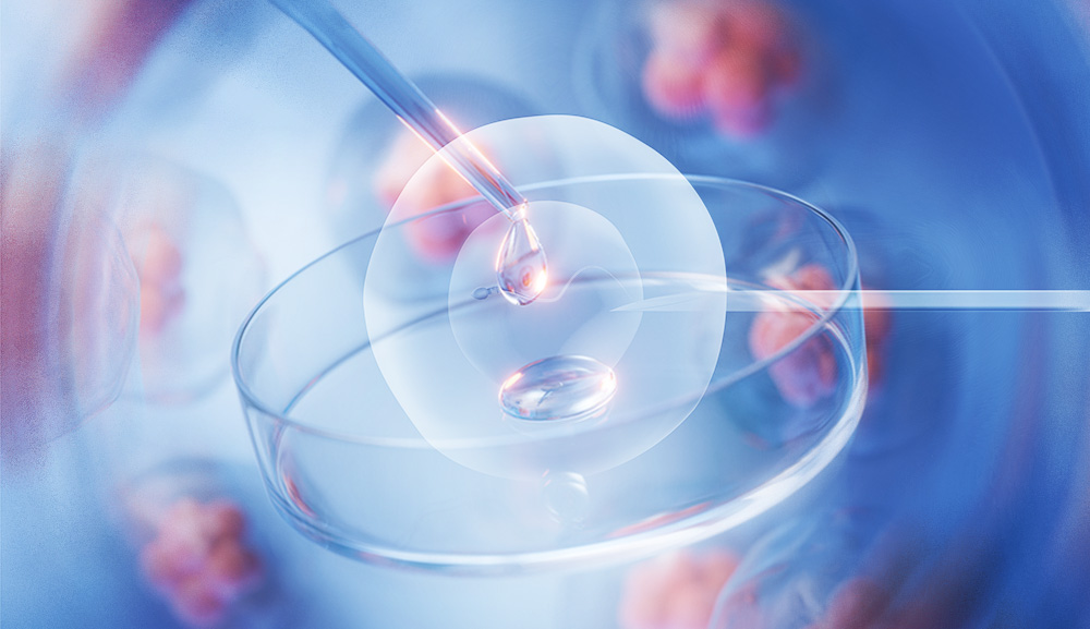 Success in Assisted Reproduction