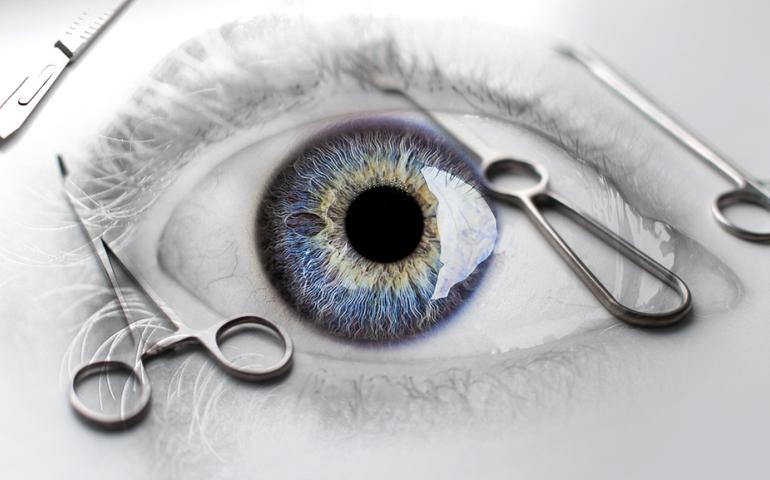 Hopeful first eyeball allotransplantation