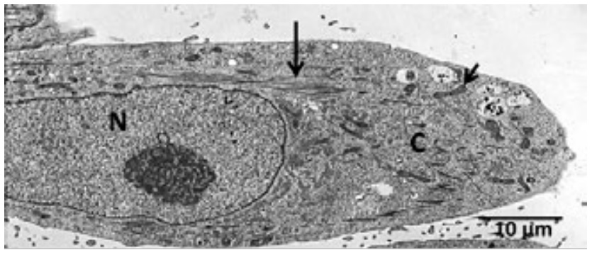 El microscopio electrónico de transmisión y la biología celular