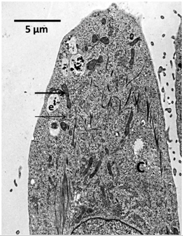 El microscopio electrónico de transmisión y la biología celular