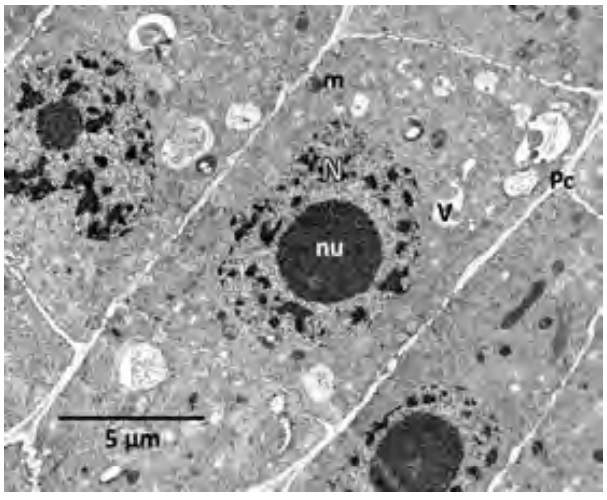 El microscopio electrónico de transmisión y la biología celular