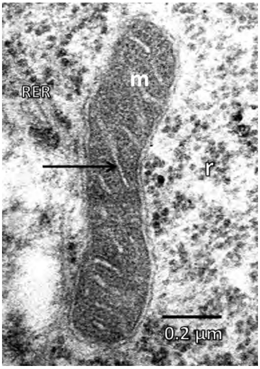 El microscopio electrónico de transmisión y la biología celular