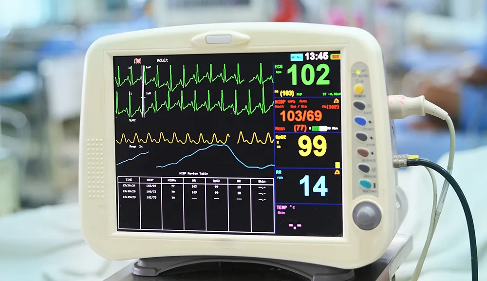 Monitor cardíaco, ¿qué es y cómo funciona?