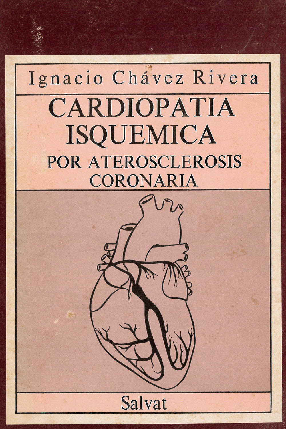 25 / 26 - RC675 C33 Cardiopatía Isquemica, Ignacio Chávez Rivera - Salvat, México 1979