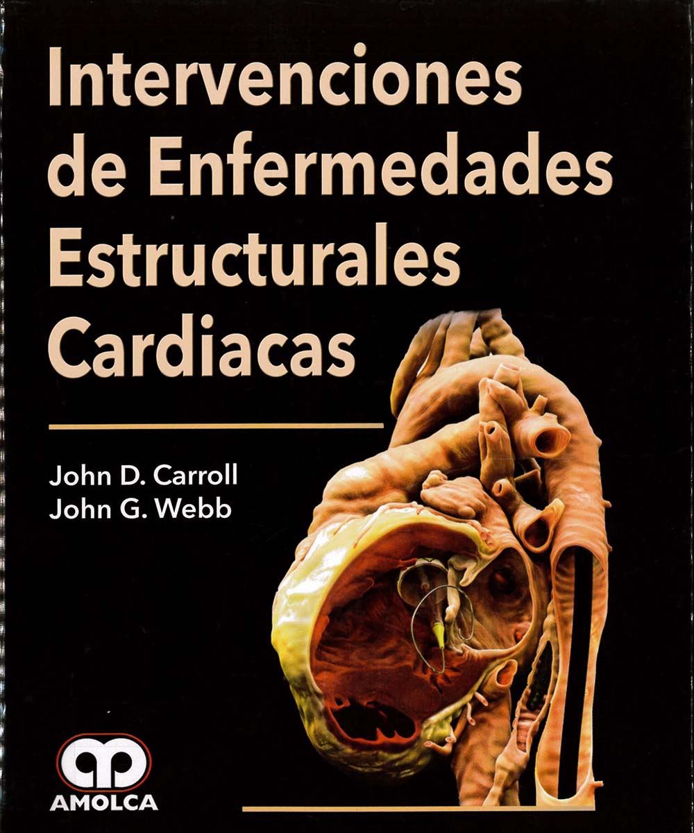13 / 13 - RD598 I-58 INTERVENCIONES DE ENFERMEDADES ESTRUCTURARES CARDIACAS, JOHN D. CARROLL - AMOLCA, MEXICO 2015