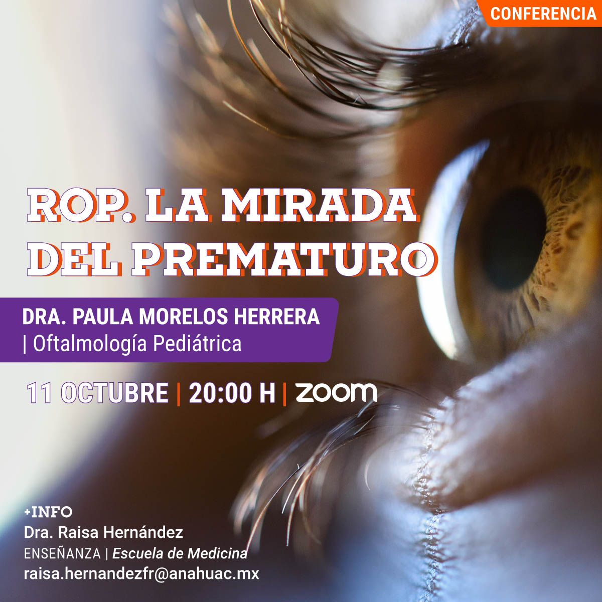 ROP. La Mirada del Prematuro