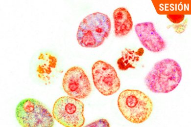 Trasplante de Células Progenitoras Hematopoyéticas